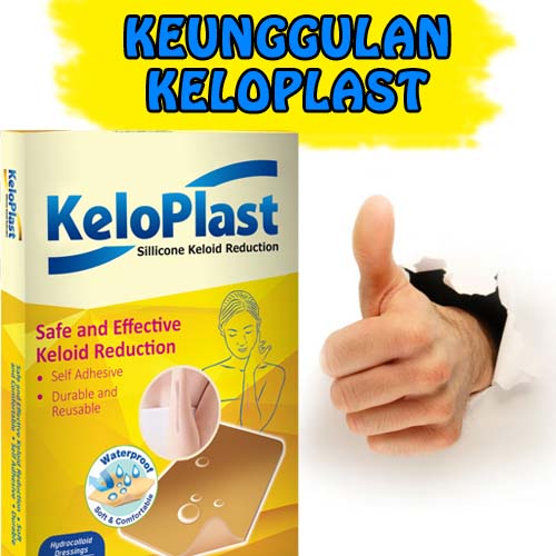 Keunggulan-Keloplast