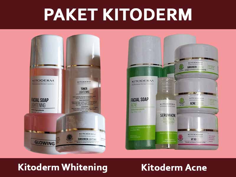 Testimoni Kitoderm Acne Cream 